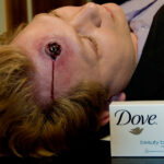 Gunshot Victim