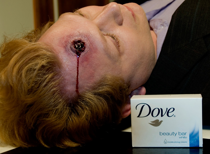 Gunshot Victim